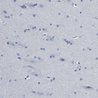 Immunohistochemical staining of human cerebral cortex shows no positivity as expected.