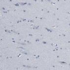 Immunohistochemical staining of human cerebral cortex shows no positivity as expected.