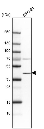 Western blot analysis in human cell line EFO-21.