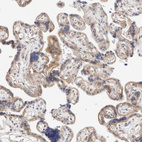 Immunohistochemical staining of human placenta shows moderate cytoplasmic positivity in trophoblastic cells.