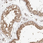 Immunohistochemical staining of human testis shows moderate cytoplasmic positivity in cells in seminiferous ducts.