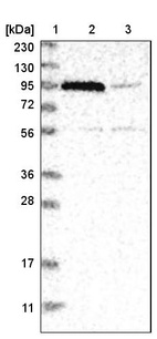 Lane 1: Marker [kDa] 230, 130, 95, 72, 56, 36, 28, 17, 11_br/_Lane 2: Human cell line RT-4_br/_Lane 3: Human cell line U-251MG sp