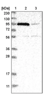 Lane 1: Marker [kDa] 230, 130, 95, 72, 56, 36, 28, 17, 11_br/_Lane 2: Human cell line RT-4_br/_Lane 3: Human cell line U-251MG sp