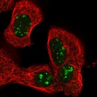 Immunofluorescent staining of human cell line A-431 shows localization to nucleoli.