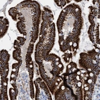 Immunohistochemical staining of human duodenum shows strong granular cytoplasmic positivity in glandular cells.