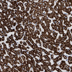 Immunohistochemical staining of human liver shows strong granular cytoplasmic positivity in hepatocytes.