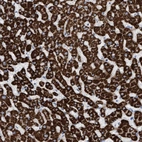 Immunohistochemical staining of human liver shows strong granular cytoplasmic positivity in hepatocytes.