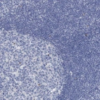 Immunohistochemical staining of human tonsil shows no positivity in non-germinal center cells as expected.