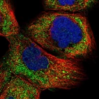 Immunofluorescent staining of human cell line A-431 shows localization to cytosol.