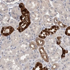 Anti-SLC45A4 Antibody