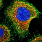 Immunofluorescent staining of human cell line A-431 shows localization to plasma membrane.
