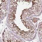 Anti-ZNF624 Antibody
