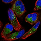 Immunofluorescent staining of human cell line RH-30 shows localization to vesicles.
