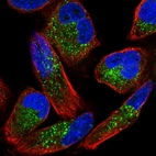 Immunofluorescent staining of human cell line RH-30 shows localization to vesicles.