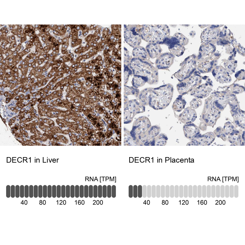 Anti-DECR1 Antibody