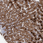 Immunohistochemical staining of human liver shows strong cytoplasmic granular positivity in hepatocytes.