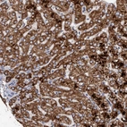 Immunohistochemical staining of human liver shows strong cytoplasmic granular positivity in hepatocytes.