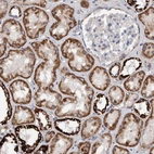 Immunohistochemical staining of human kidney shows strong cytoplasmic granular positivity in cells in tubules.