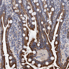 Immunohistochemical staining of human duodenum shows strong cytoplasmic granular positivity in glandular cells.