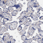 Immunohistochemical staining of human placenta shows no positivity in trophoblastic cells as expected.