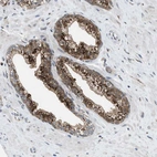 Immunohistochemical staining of human prostate shows moderate to strong cytoplasmic positivity in glandular cells.