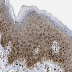 Immunohistochemical staining of human skin shows weak cytoplasmic positivity in keratinocytes.