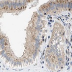 Immunohistochemical staining of human gallbladder using Anti-SLC38A10 antibody HPA023161.