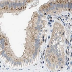 Immunohistochemical staining of human gallbladder using Anti-SLC38A10 antibody HPA023161.