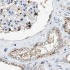 Immunohistochemical staining of human kidney using Anti-SLC38A10 antibody HPA023161.