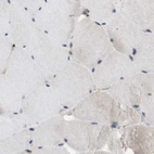 Immunohistochemical staining of human skeletal muscle using Anti-SLC38A10 antibody HPA023161.