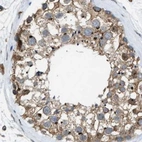 Immunohistochemical staining of human testis using Anti-SLC38A10 antibody HPA023161.