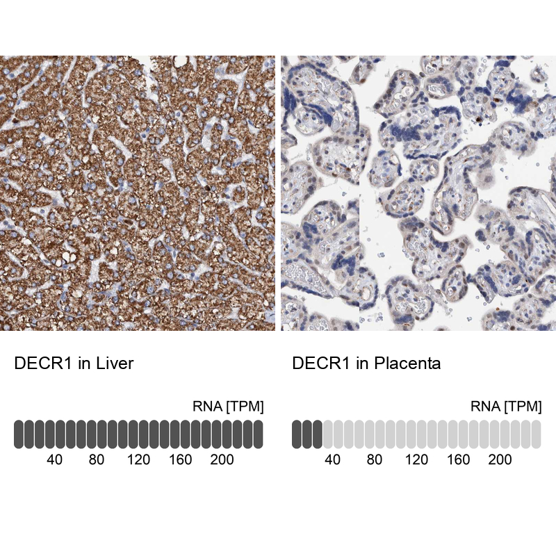 Anti-DECR1 Antibody