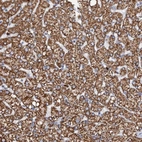 Immunohistochemical staining of human liver shows strong cytoplasmic granular positivity in hepatocytes.