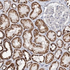 Immunohistochemical staining of human kidney shows strong cytoplasmic granular positivity in cells in tubules.
