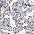 Immunohistochemical staining of human placenta shows no positivity in trophoblastic cells as expected.
