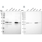Western blot analysis using Anti-DECR1 antibody HPA023162 (A) shows similar pattern to independent antibody HPA023238 (B).