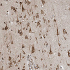 Immunohistochemical staining of human cerebral cortex shows strong cytoplasmic positivity in neurons.