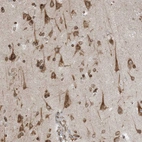 Immunohistochemical staining of human cerebral cortex shows strong cytoplasmic positivity in neurons.