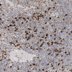 Immunohistochemical staining of human lymph node shows strong cytoplasmic positivity in non-germinal center cells.