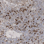 Immunohistochemical staining of human lymph node shows strong cytoplasmic positivity in non-germinal center cells.