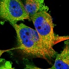 Immunofluorescent staining of human cell line U-251 MG shows localization to plasma membrane & cytosol.