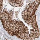 Anti-NUDCD1 Antibody