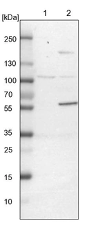 Lane 1: NIH-3T3 cell lysate (Mouse embryonic fibroblast cells)_br/_Lane 2: NBT-II cell lysate (Rat Wistar bladder tumour cells)