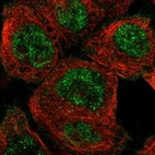 Immunofluorescent staining of human cell line A-431 shows localization to nucleoplasm.
