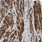 Anti-TMEM70 Antibody