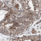 Immunohistochemical staining of human Testis shows strong granular cytoplasmic positivity in Leydig cells and cells in seminiferous ducts.