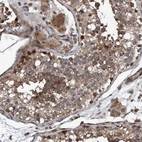 Immunohistochemical staining of human Testis shows strong granular cytoplasmic positivity in Leydig cells and cells in seminiferous ducts.
