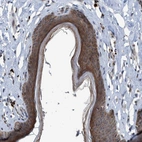 Immunohistochemical staining of human Skin shows strong cytoplasmic positivity in squamous epithelial cells.
