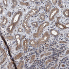 Immunohistochemical staining of human Kidney shows moderate granular cytoplasmic positivity in cells in tubules.