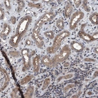Immunohistochemical staining of human Kidney shows moderate granular cytoplasmic positivity in cells in tubules.